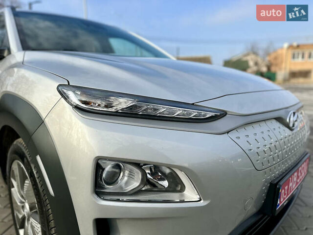 Серый Хендай Kona, объемом двигателя 0 л и пробегом 86 тыс. км за 16000 $, фото 4 на Automoto.ua