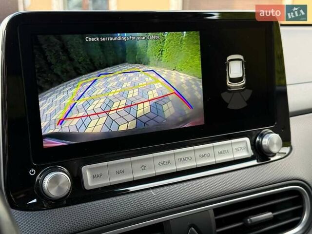 Сірий Хендай Kona, об'ємом двигуна 0 л та пробігом 36 тис. км за 16400 $, фото 35 на Automoto.ua