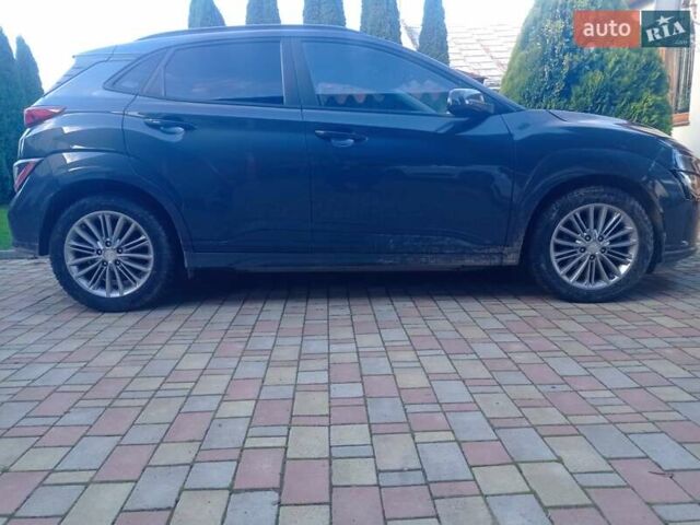 Серый Хендай Kona, объемом двигателя 0 л и пробегом 75 тыс. км за 17435 $, фото 10 на Automoto.ua