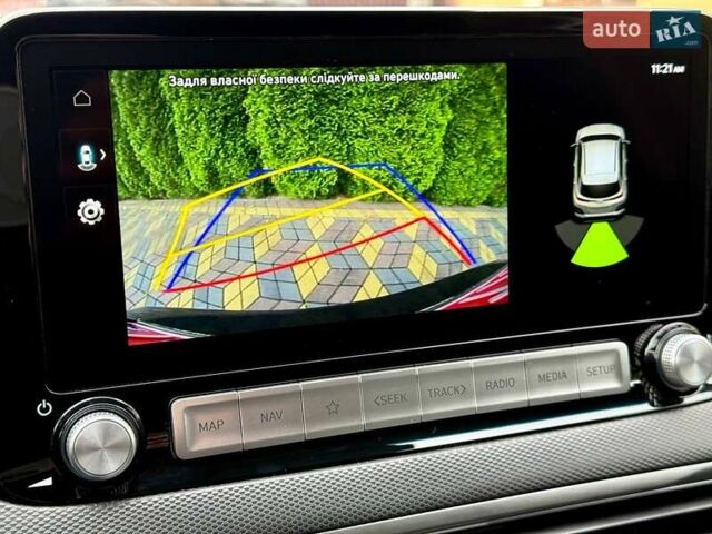 Серый Хендай Kona, объемом двигателя 0 л и пробегом 52 тыс. км за 17200 $, фото 38 на Automoto.ua