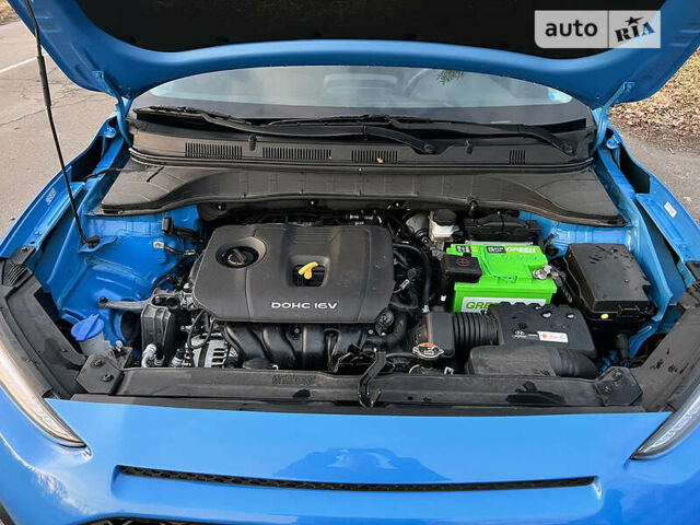 Синій Хендай Kona, об'ємом двигуна 2 л та пробігом 80 тис. км за 14500 $, фото 25 на Automoto.ua
