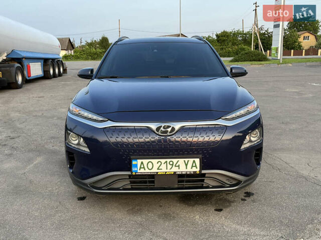 Синій Хендай Kona, об'ємом двигуна 0 л та пробігом 81 тис. км за 17000 $, фото 20 на Automoto.ua