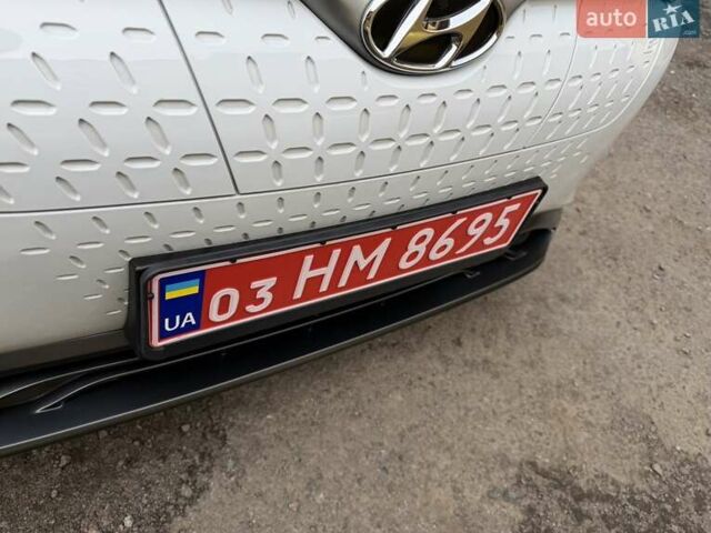 Білий Хендай Kona Electric, об'ємом двигуна 0 л та пробігом 64 тис. км за 14950 $, фото 20 на Automoto.ua