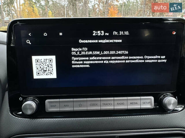 Белый Хендай Kona Electric, объемом двигателя 0 л и пробегом 58 тыс. км за 17499 $, фото 102 на Automoto.ua