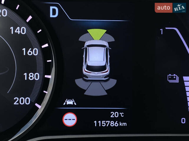 Білий Хендай Kona Electric, об'ємом двигуна 0 л та пробігом 115 тис. км за 18700 $, фото 72 на Automoto.ua