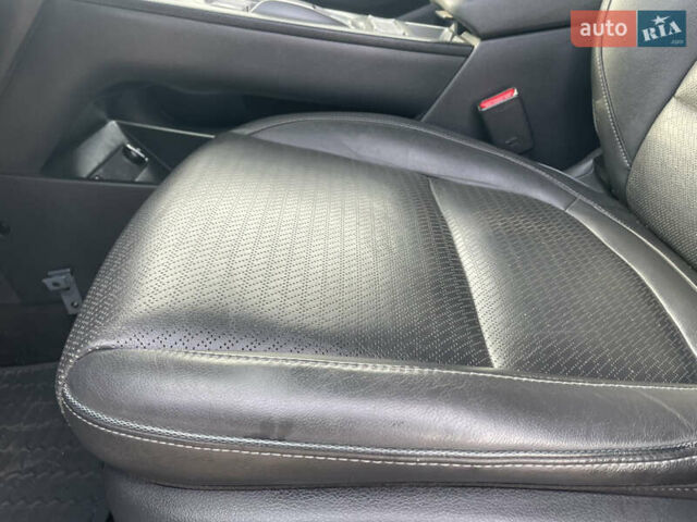 Белый Хендай Kona Electric, объемом двигателя 0 л и пробегом 117 тыс. км за 16500 $, фото 26 на Automoto.ua