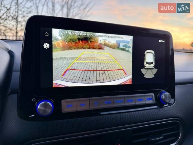 Белый Хендай Kona Electric, объемом двигателя 0 л и пробегом 78 тыс. км за 17250 $, фото 65 на Automoto.ua