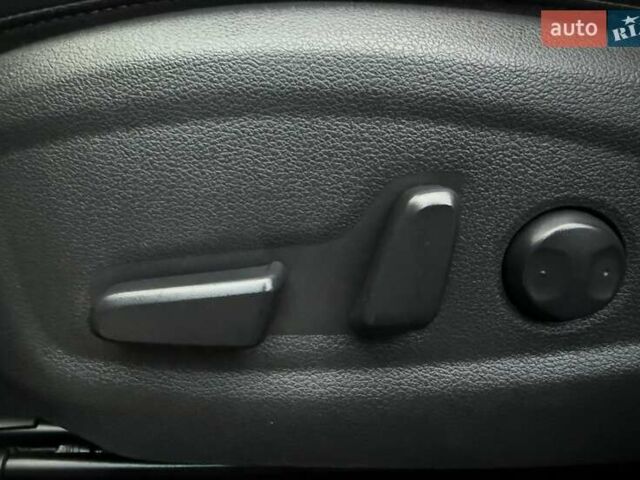 Белый Хендай Kona Electric, объемом двигателя 0 л и пробегом 92 тыс. км за 17950 $, фото 75 на Automoto.ua