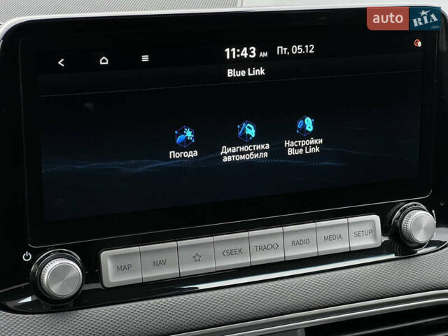 Белый Хендай Kona Electric, объемом двигателя 0 л и пробегом 111 тыс. км за 18570 $, фото 79 на Automoto.ua