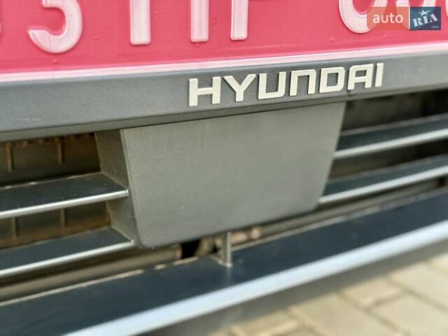 Белый Хендай Kona Electric, объемом двигателя 0 л и пробегом 78 тыс. км за 17250 $, фото 25 на Automoto.ua