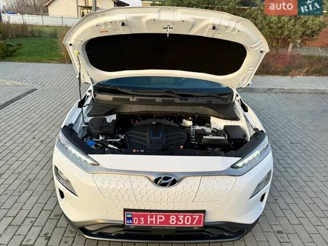 Белый Хендай Kona Electric, объемом двигателя 0 л и пробегом 78 тыс. км за 17250 $, фото 101 на Automoto.ua