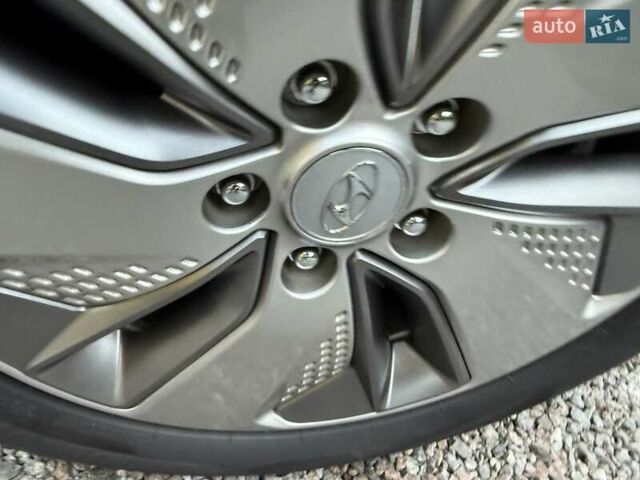 Белый Хендай Kona Electric, объемом двигателя 0 л и пробегом 92 тыс. км за 17950 $, фото 37 на Automoto.ua