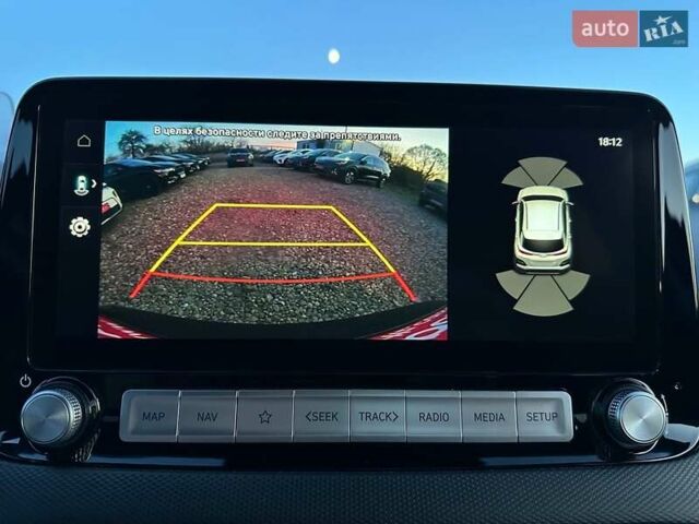 Черный Хендай Kona Electric, объемом двигателя 0 л и пробегом 86 тыс. км за 21500 $, фото 14 на Automoto.ua