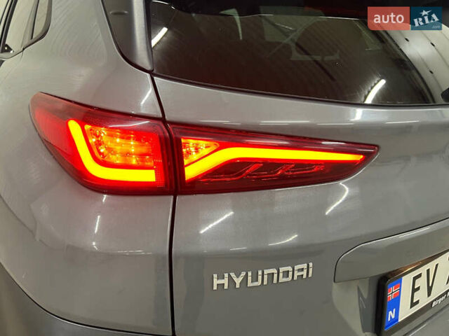 Серый Хендай Kona Electric, объемом двигателя 0 л и пробегом 102 тыс. км за 14200 $, фото 8 на Automoto.ua