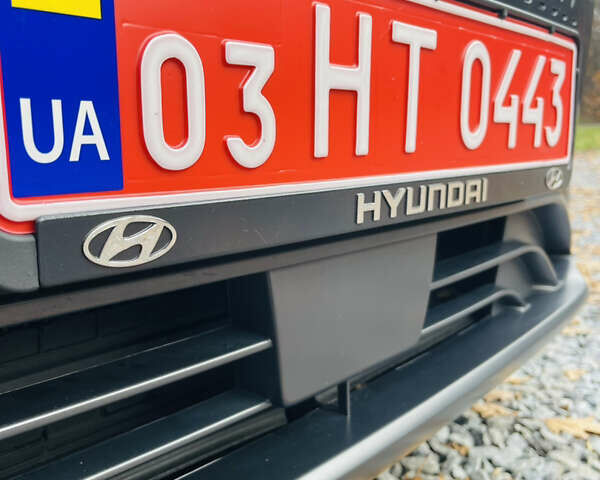 Серый Хендай Kona Electric, объемом двигателя 0 л и пробегом 112 тыс. км за 16700 $, фото 31 на Automoto.ua