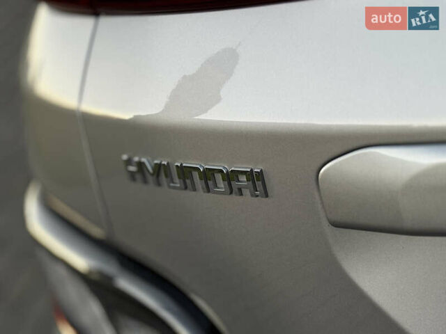 Серый Хендай Kona Electric, объемом двигателя 0 л и пробегом 80 тыс. км за 20700 $, фото 18 на Automoto.ua