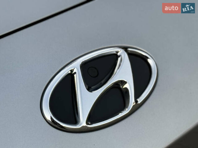 Серый Хендай Kona Electric, объемом двигателя 0 л и пробегом 80 тыс. км за 20700 $, фото 9 на Automoto.ua