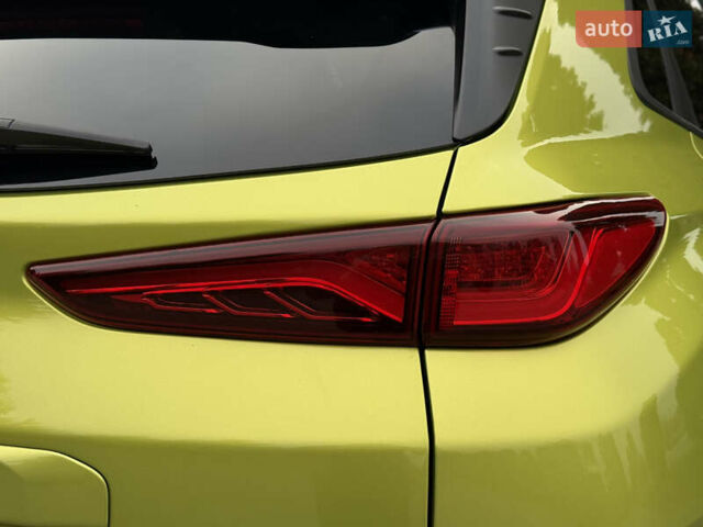 Зеленый Хендай Kona Electric, объемом двигателя 0 л и пробегом 103 тыс. км за 17300 $, фото 16 на Automoto.ua