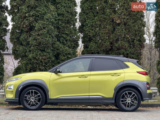 Зеленый Хендай Kona Electric, объемом двигателя 0 л и пробегом 103 тыс. км за 17300 $, фото 4 на Automoto.ua