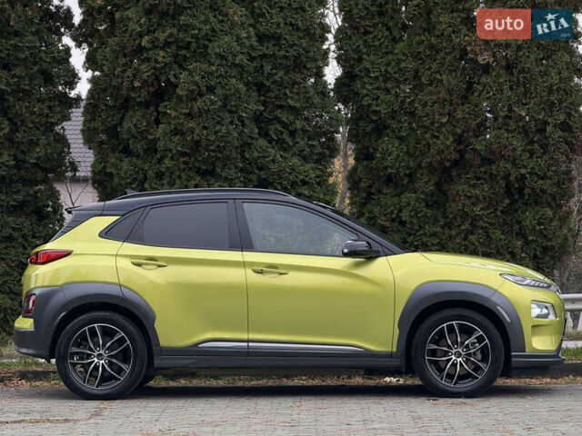 Зеленый Хендай Kona Electric, объемом двигателя 0 л и пробегом 103 тыс. км за 17300 $, фото 5 на Automoto.ua