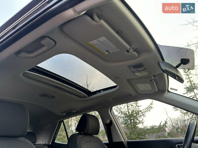 Черный Хендай Venue, объемом двигателя 1.59 л и пробегом 133 тыс. км за 14600 $, фото 43 на Automoto.ua