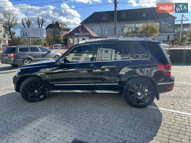 Мерседес ГЛК-Класс 2010 в Коломые на Automoto.ua Черный Мерседес ГЛК-Класс, объемом двигателя 2.14 л и пробегом 261 тыс. км за 11800 $, фото 15 на Automoto.ua